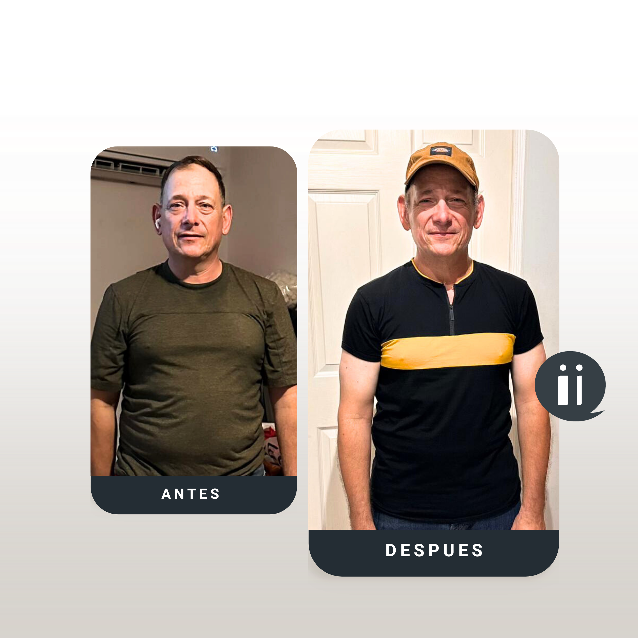 Antes / Después 1