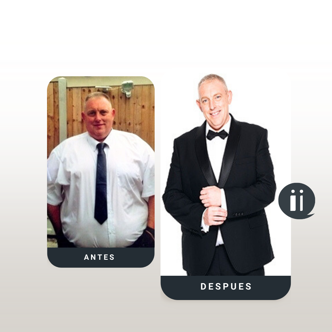 Antes / Después 11