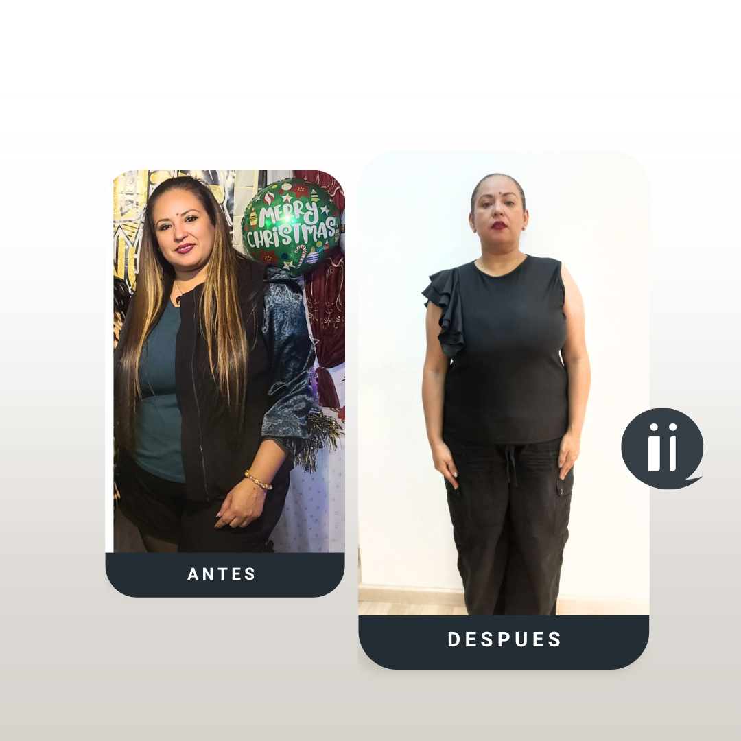 Antes / Después 12