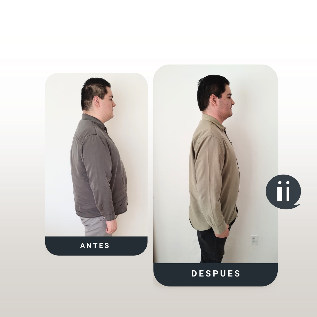 Antes / Después 15
